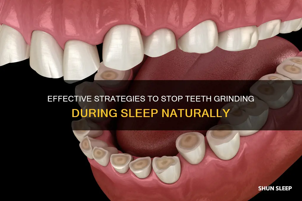 how to help stop teeth grinding in sleep