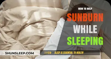 Soothing Sunburn Relief: Overnight Remedies for Healing While You Sleep