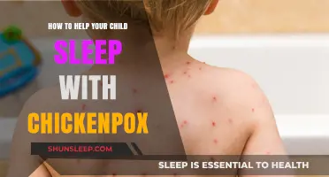 Soothing Chickenpox Itch: Tips for Better Child Sleep During Recovery
