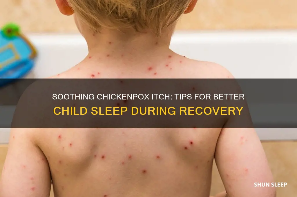 how to help your child sleep with chickenpox