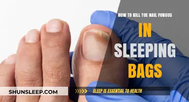Eradicate Toe Nail Fungus from Sleeping Bags: Tips and Tricks