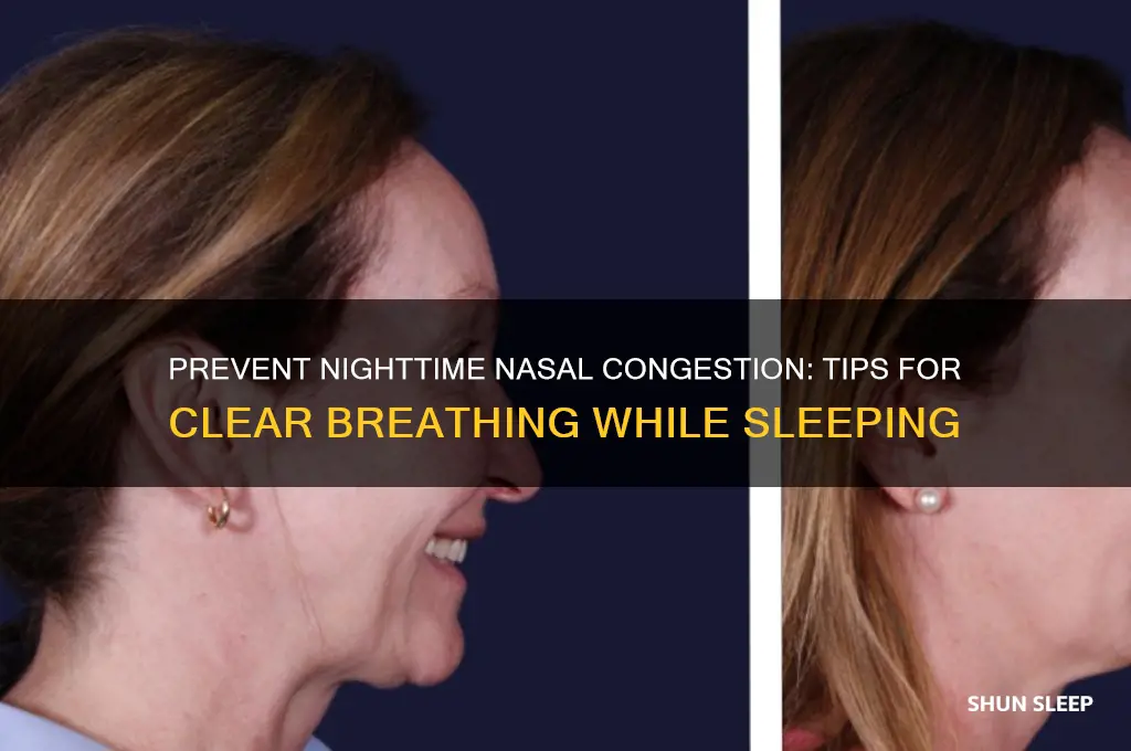 how to not get a blocked nose while sleeping