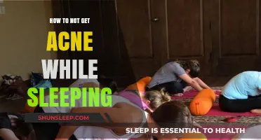 Sleep Clear: Nighttime Habits to Prevent Acne Breakouts
