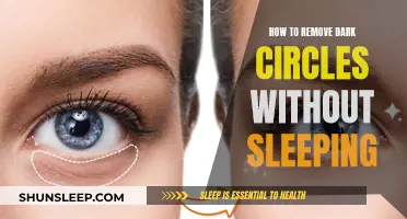 Eradicate Dark Circles: Strategies Beyond Just Getting Sleep