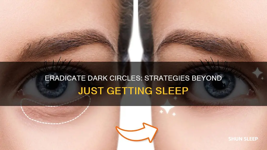 how to remove dark circles without sleeping