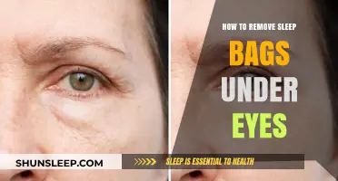 Erase Under-Eye Bags: Simple, Effective Home Remedies