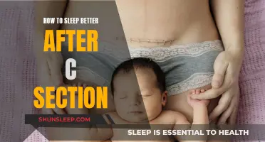 Postpartum Rest: Sleeping Well After a C-Section