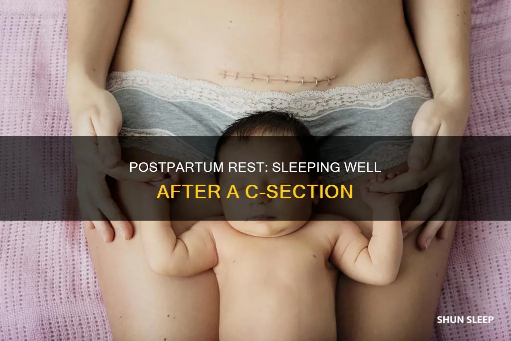 how to sleep better after c section