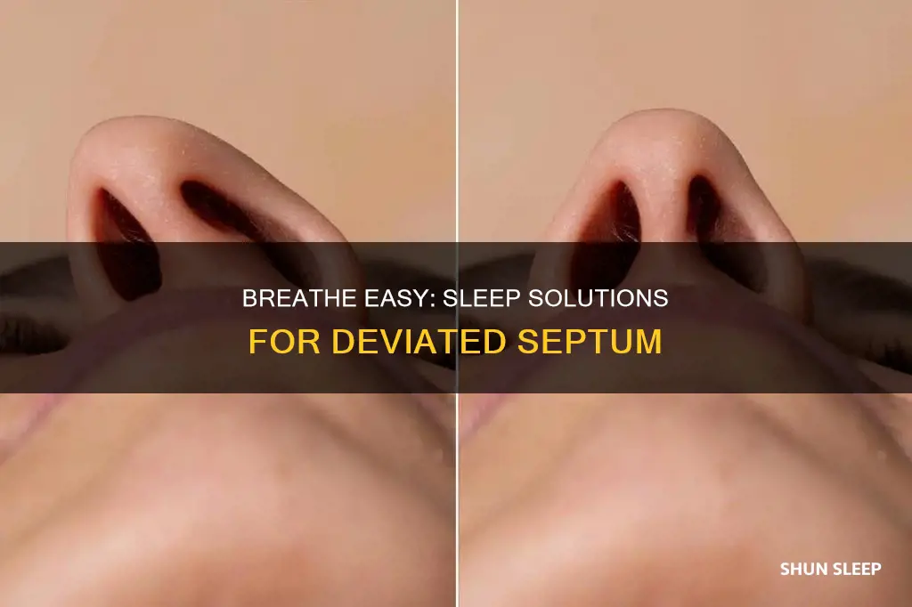 how to sleep better with a deviated septum