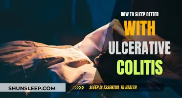 Ulcerative Colitis: Sleeping Better with Fewer Flares