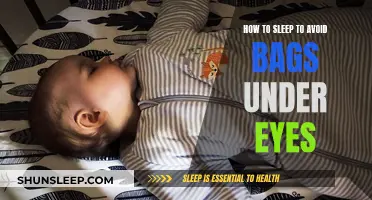 Sleep to banish under-eye bags