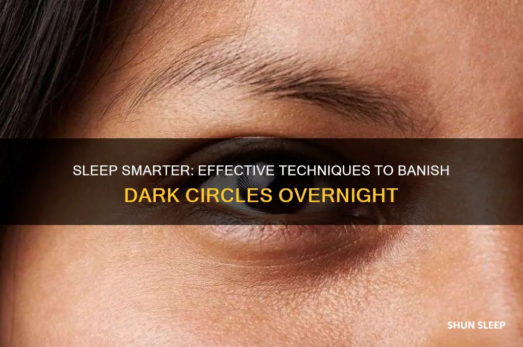 how to sleep to get rid of dark circles