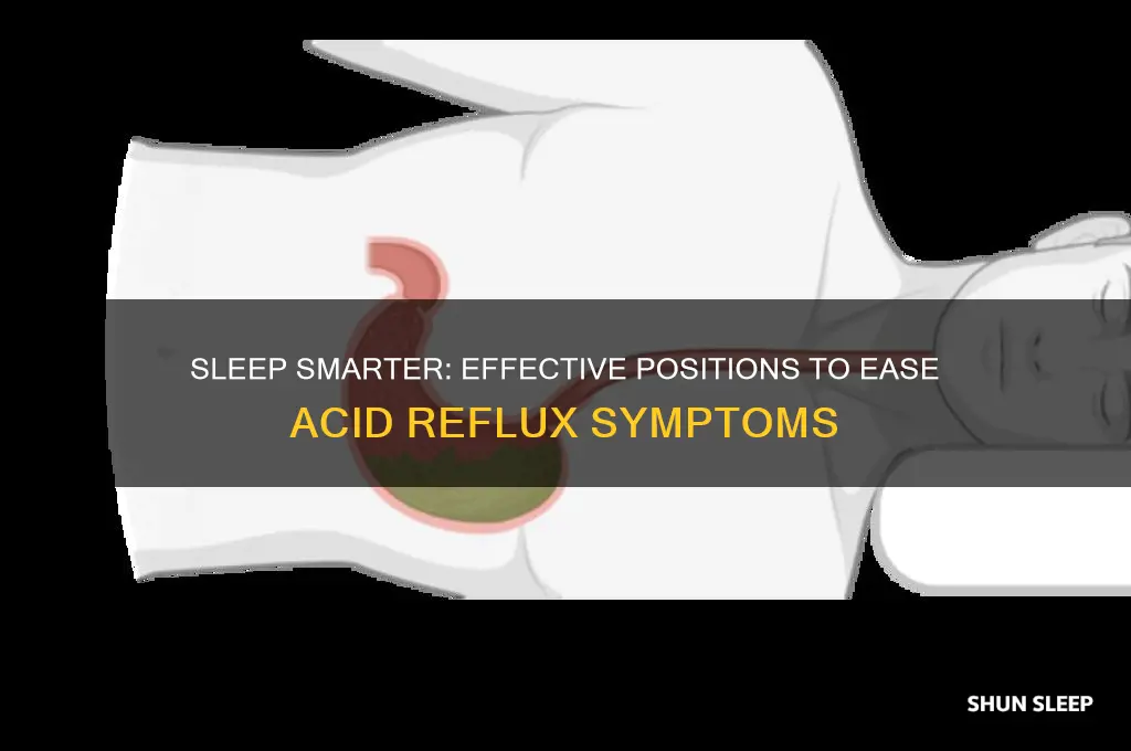 how to sleep to help acid reflux