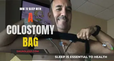 Living with a Colostomy Bag: Tips for Better Sleep