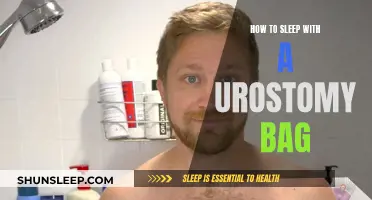 Living with a Urostomy Bag: Sleeping Tips