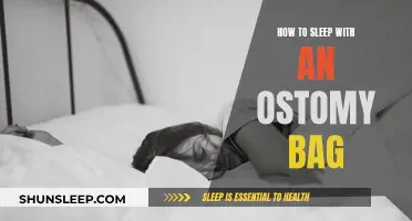 Living with an Ostomy Bag: Sleeping Tips