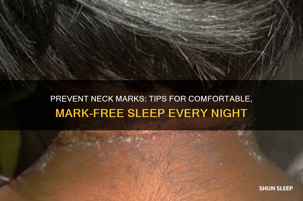 how to stop getting neck marks from sleeping