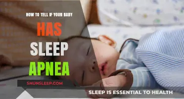 Signs Your Baby May Have Sleep Apnea: What Parents Need to Know