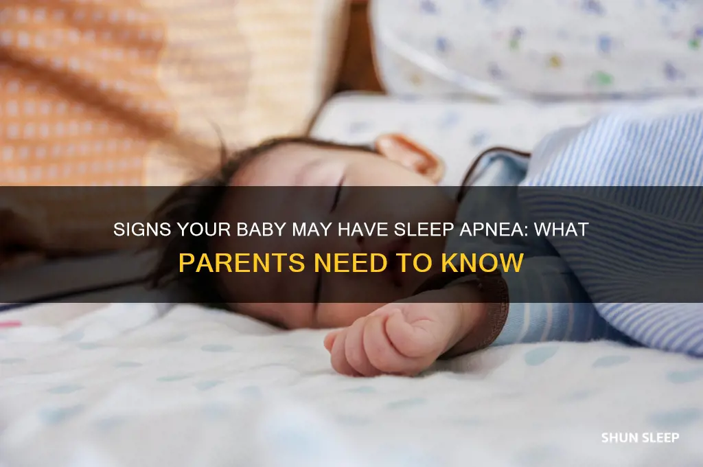 how to tell if your baby has sleep apnea