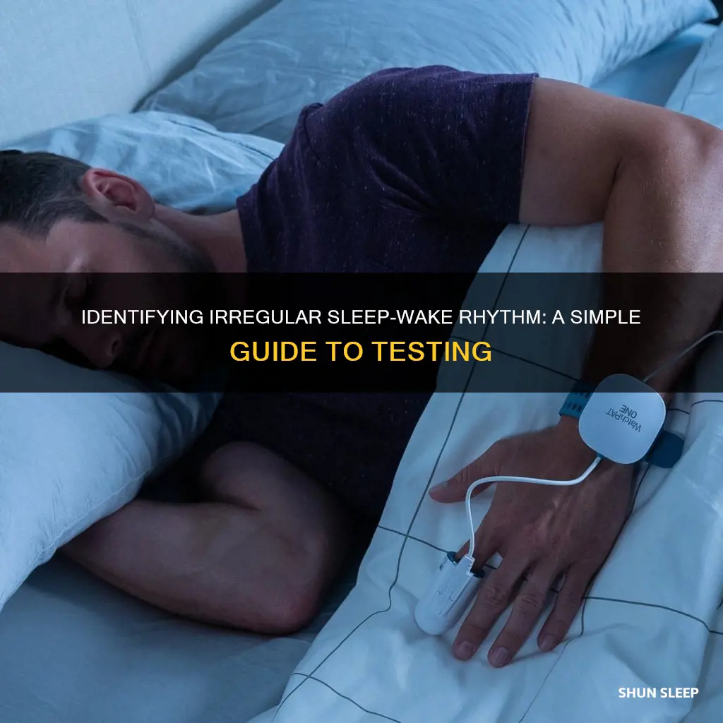how to test for irregular sleep-wake rhythm