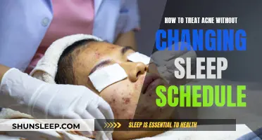 Treating Acne: Night Routine Tips for Clear Skin