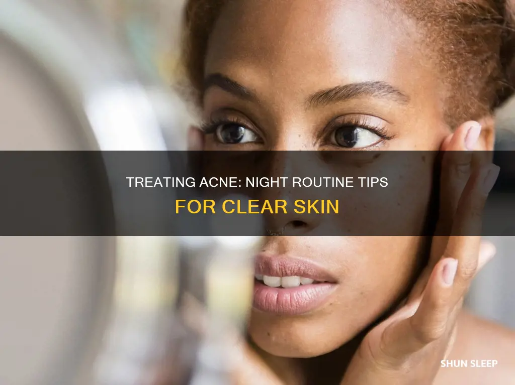 how to treat acne without changing sleep schedule