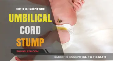 Using Sleepers with Umbilical Cord Stumps: A Safe Guide