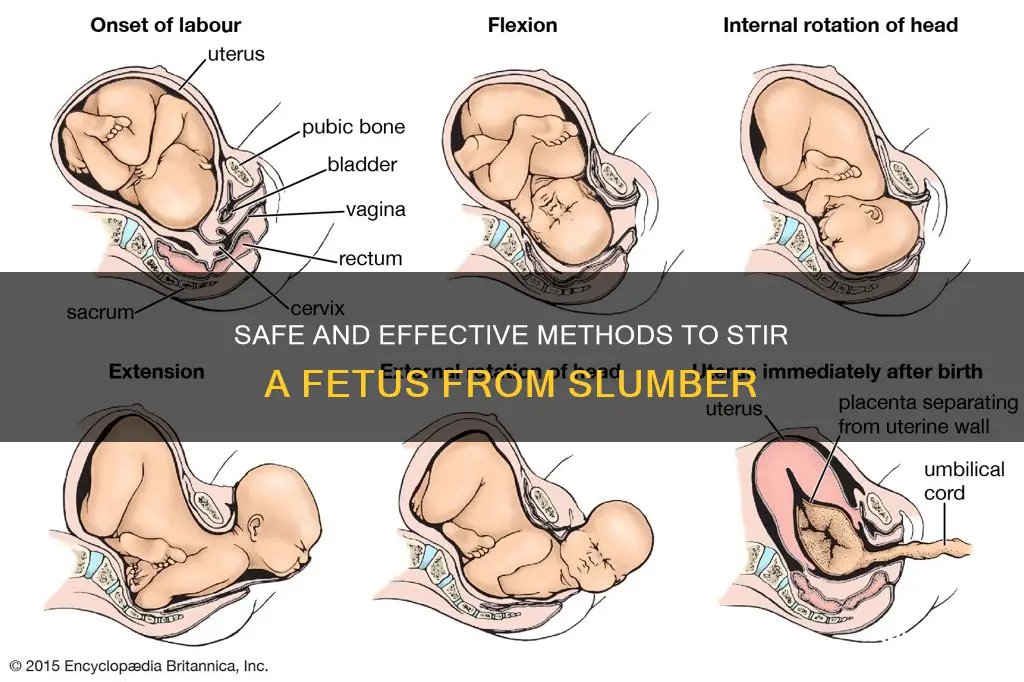 how to wake up a sleeping fetus