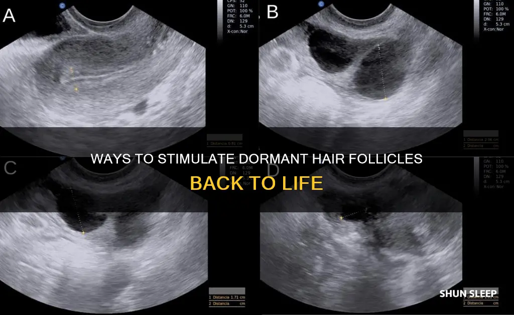 how to wake up sleeping follicles