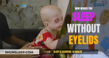 A World Without Eyelids: Sleep and the Unblinking Eye