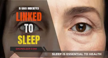 Undereye Bags: Sleep Deprivation's Ugly Calling Card