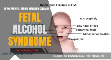 Excessive Sleeping in Newborns: A Common Sign of Fetal Alcohol Syndrome?