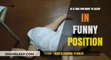 Funny Baby Sleep Positions: Safe or Cause for Concern?