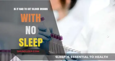 No Sleep Before Blood Draw: Risks and Considerations Explained