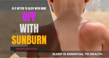 Sunburn: Sleep Shirtless to Soothe Skin