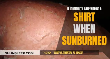 Sunburn Care: Sleep Shirtless for Faster Healing
