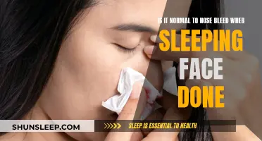 Nosebleeds When Sleeping: Face-Down Normal?