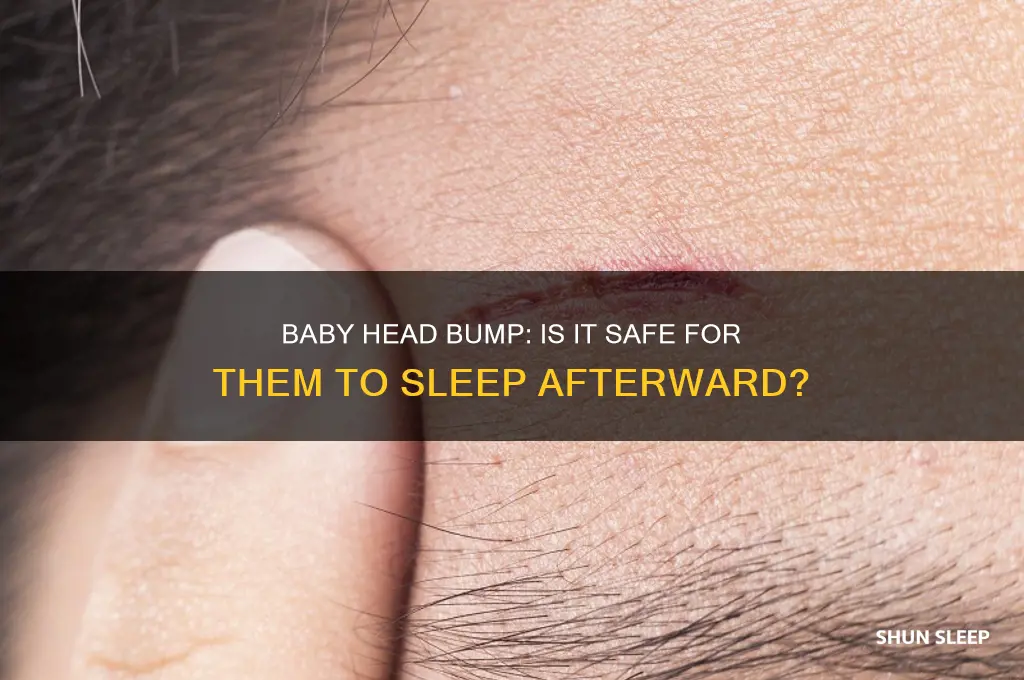 is it okay for baby to sleep after bumping head