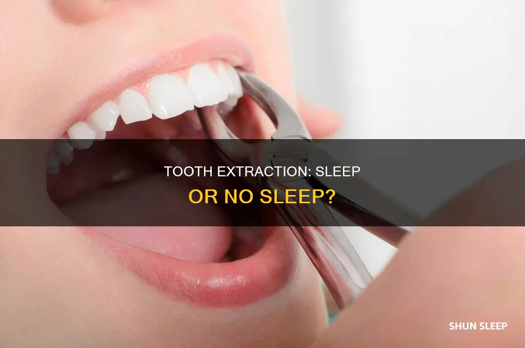 is it okay to have a tooth extraction without sleep
