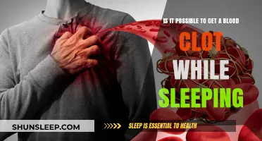 Can Sleep Cause Blood Clots? Uncovering the Risks and Facts