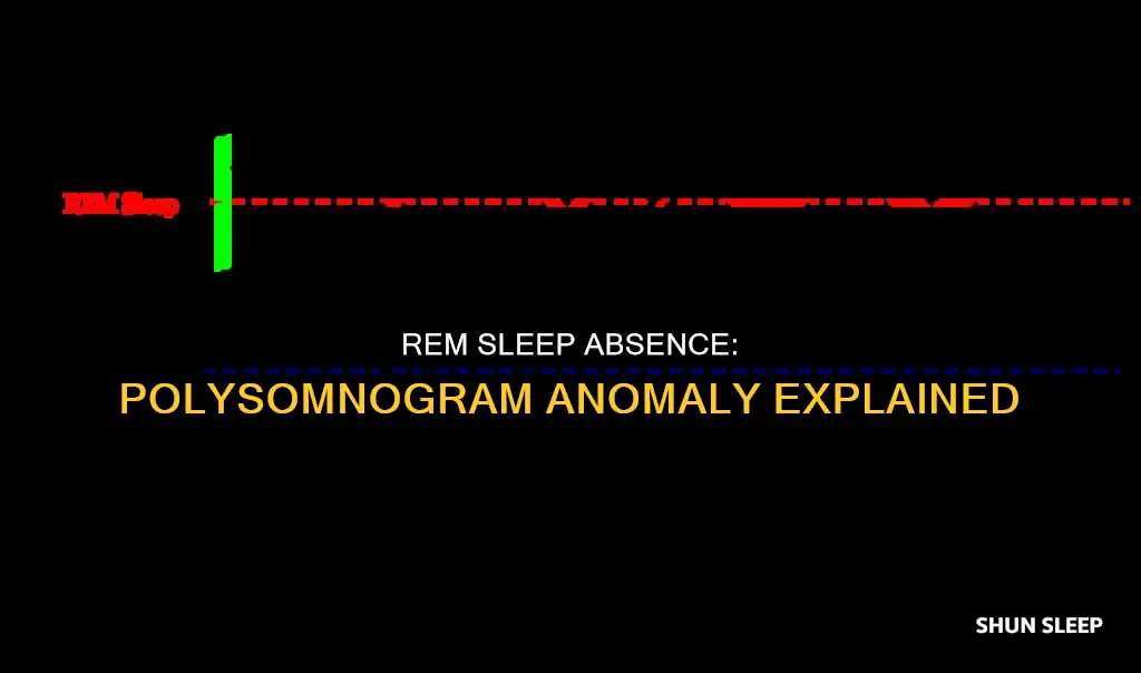 is it unusual not to have rem sleep during polysomnogram