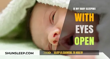 Is My Baby Sleeping with Eyes Open? Understanding Nocturnal Nystagmus