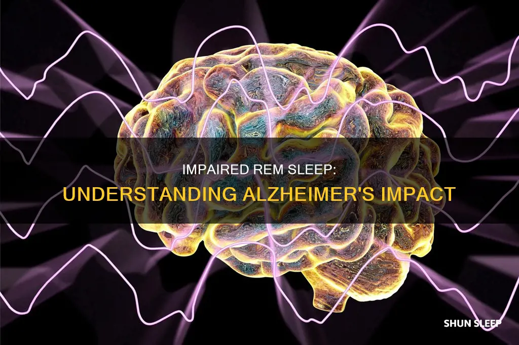 is rem sleep impaired in adividuals with alziemeres dieaseasde