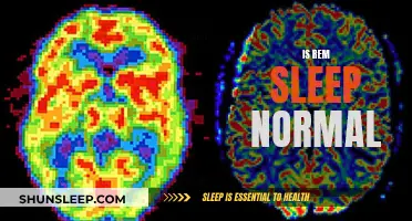 Understanding REM Sleep: What's Normal and What's Not