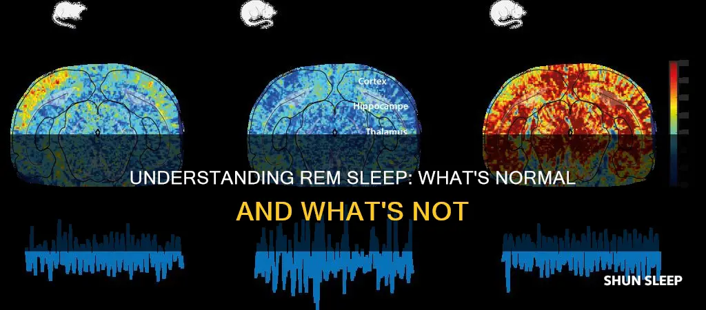 is rem sleep normal