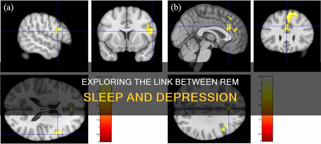 is rem sleep related to depression