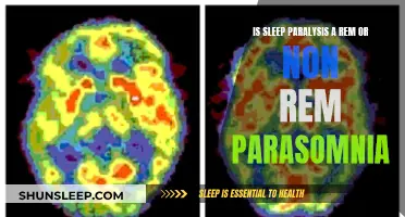 Sleep Paralysis: REM or Non-REM Parasomnia?