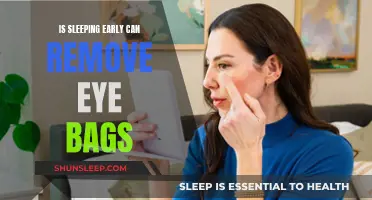 Early Sleep, Eye Bags' Healer?