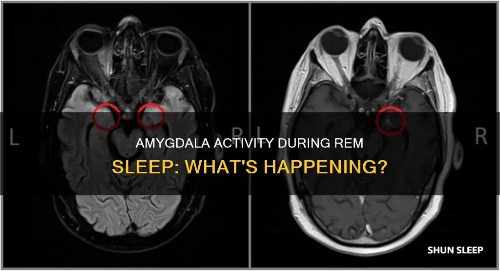 is the amygdala active during rem sleep