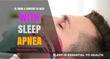 Exploring Surgical Options for Sleep Apnea Relief: What You Need to Know
